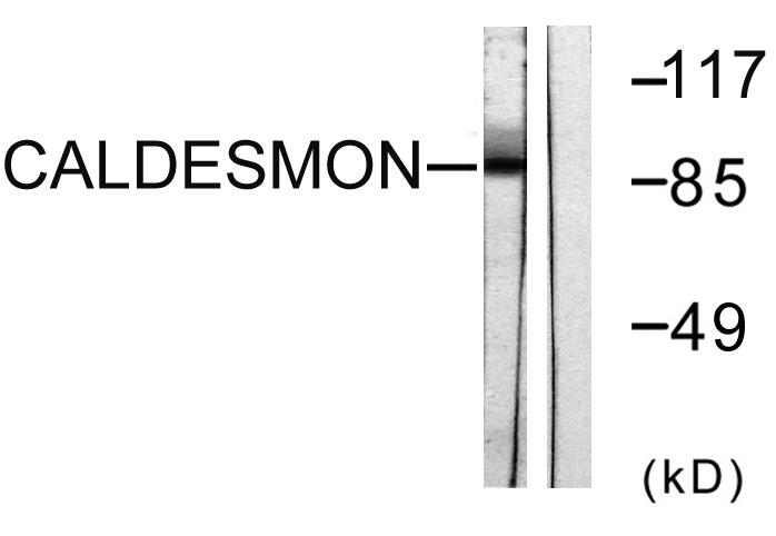 Caldesmon Rabbit Polyclonal Antibody | 兔多抗 | EnkiLife恩玑生命