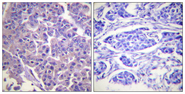 Caldesmon Rabbit Polyclonal Antibody | 兔多抗 | EnkiLife恩玑生命