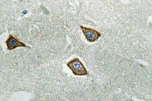 Calpain?2 Rabbit Polyclonal Antibody | 兔多抗 | EnkiLife恩玑生命