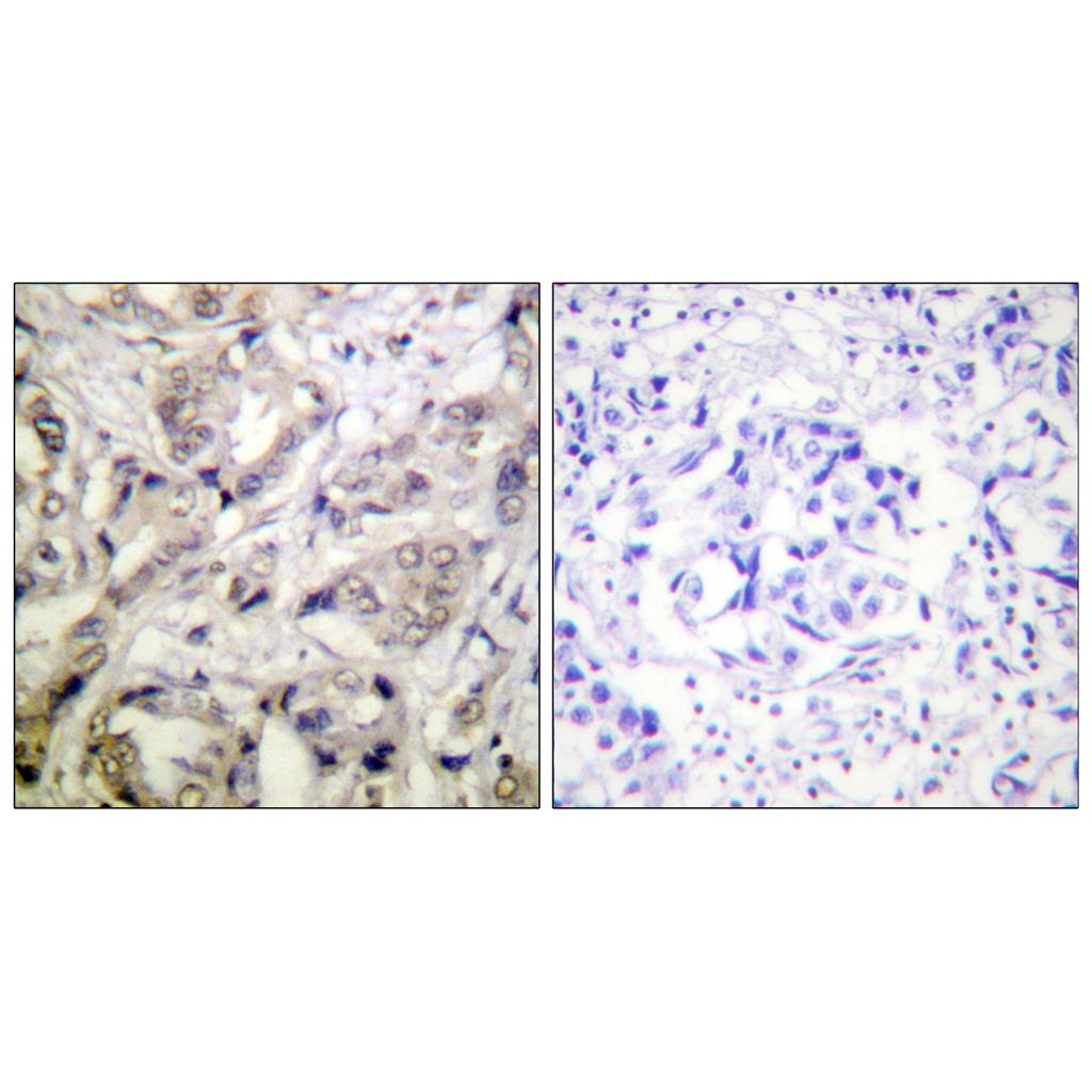 CaMKIα Rabbit Polyclonal Antibody | 兔多抗 | EnkiLife恩玑生命