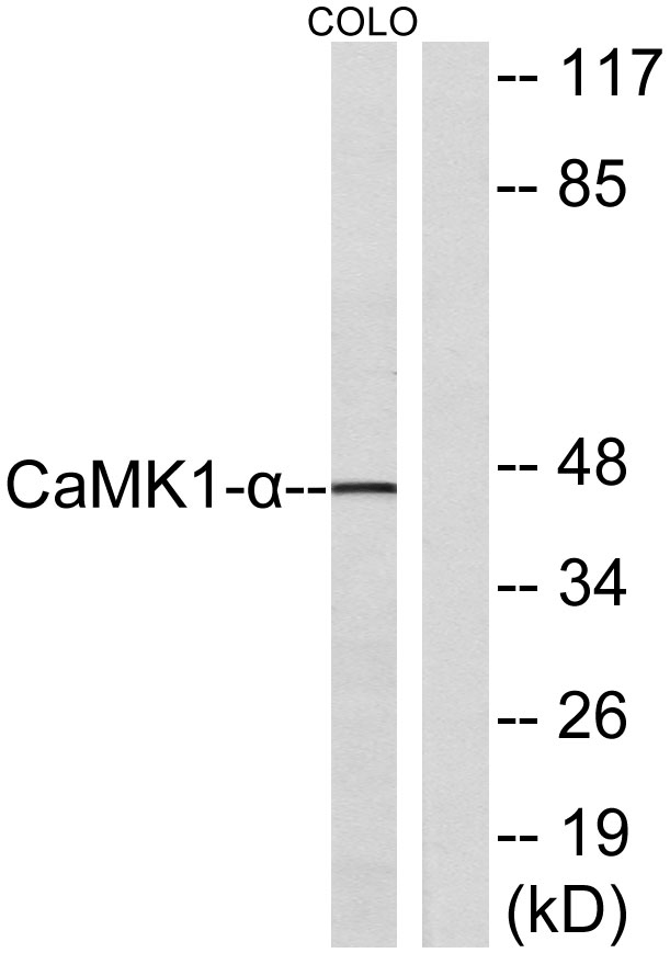 CaMKIα Rabbit Polyclonal Antibody | 兔多抗 | EnkiLife恩玑生命