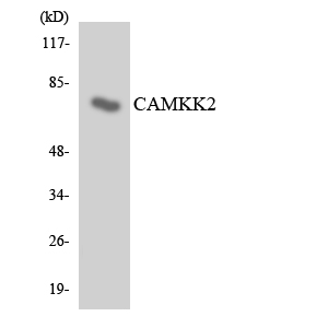 CaMKK2 Rabbit Polyclonal Antibody | 兔多抗 | EnkiLife恩玑生命