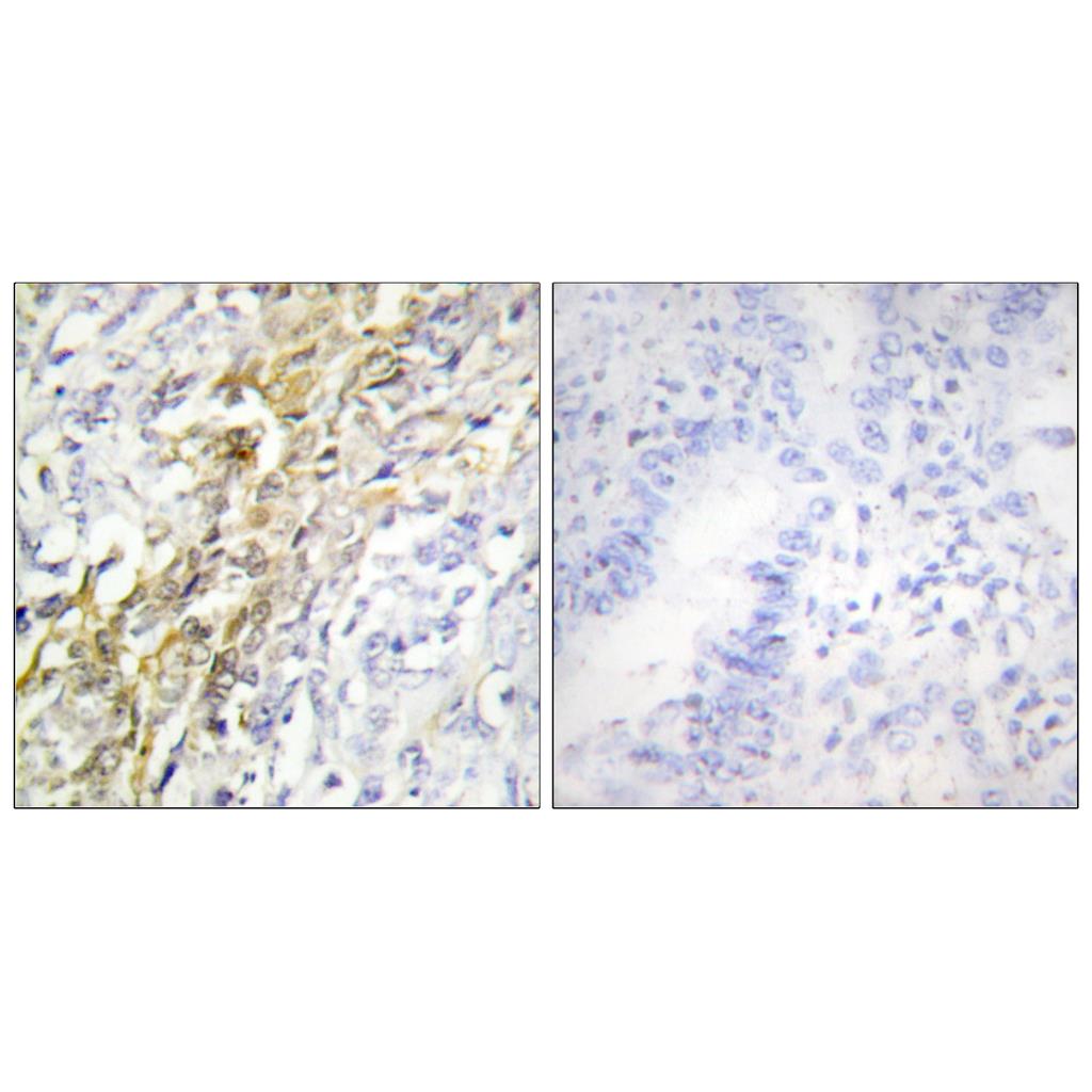 Casein Kinase Iα Rabbit Polyclonal Antibody | 兔多抗 | EnkiLife恩玑生命
