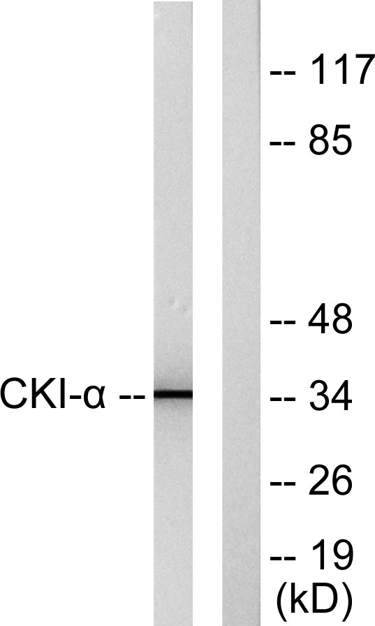 Casein Kinase Iα Rabbit Polyclonal Antibody | 兔多抗 | EnkiLife恩玑生命
