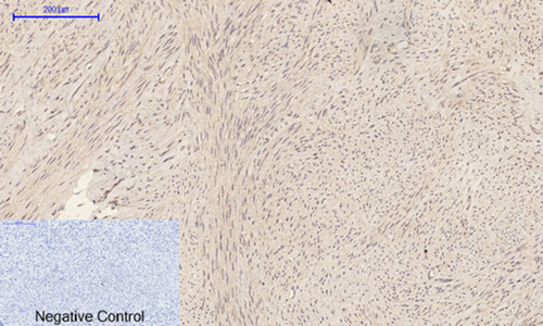 Caspase-1 Rabbit Polyclonal Antibody | 兔多抗 | EnkiLife恩玑生命