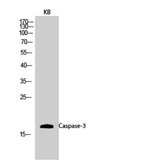Caspase-3 Rabbit Polyclonal Antibody | 兔多抗 | EnkiLife恩玑生命