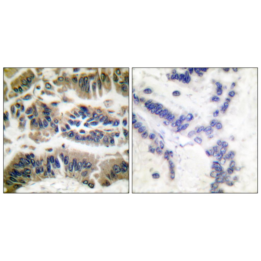 Caspase-6 Rabbit Polyclonal Antibody | 兔多抗 | EnkiLife恩玑生命