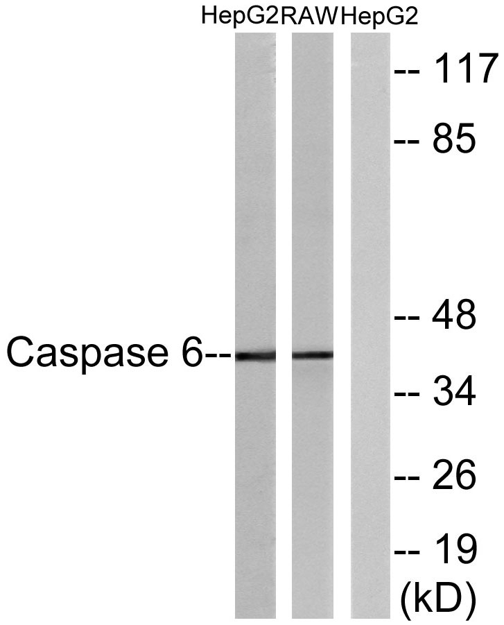 Caspase-6 Rabbit Polyclonal Antibody | 兔多抗 | EnkiLife恩玑生命