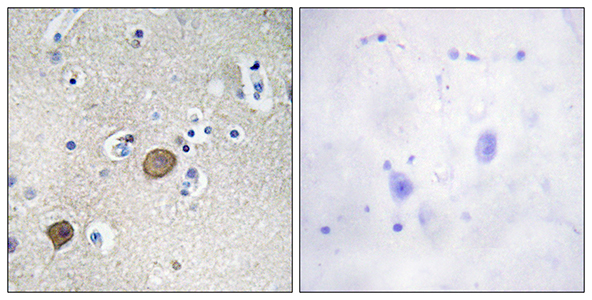 Catenin-α1 Rabbit Polyclonal Antibody | 兔多抗 | EnkiLife恩玑生命