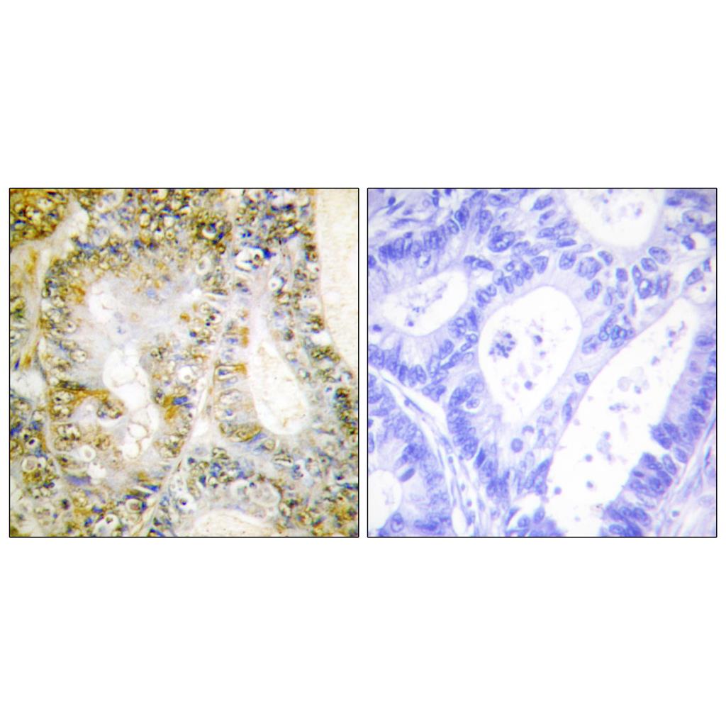 Catenin-β1 Rabbit Polyclonal Antibody | 兔多抗 | EnkiLife恩玑生命
