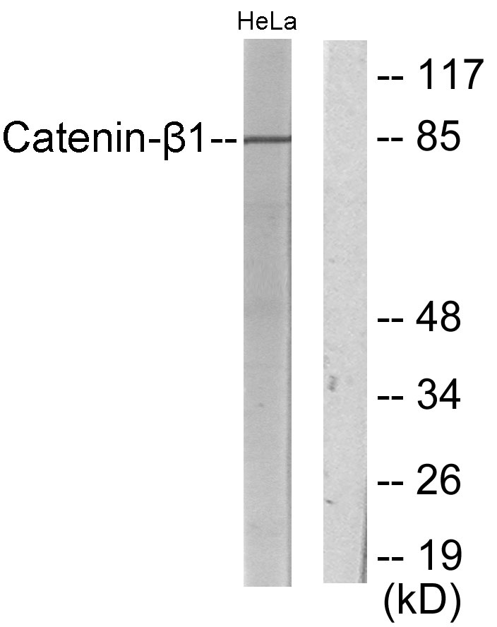 Catenin-β1 Rabbit Polyclonal Antibody | 兔多抗 | EnkiLife恩玑生命