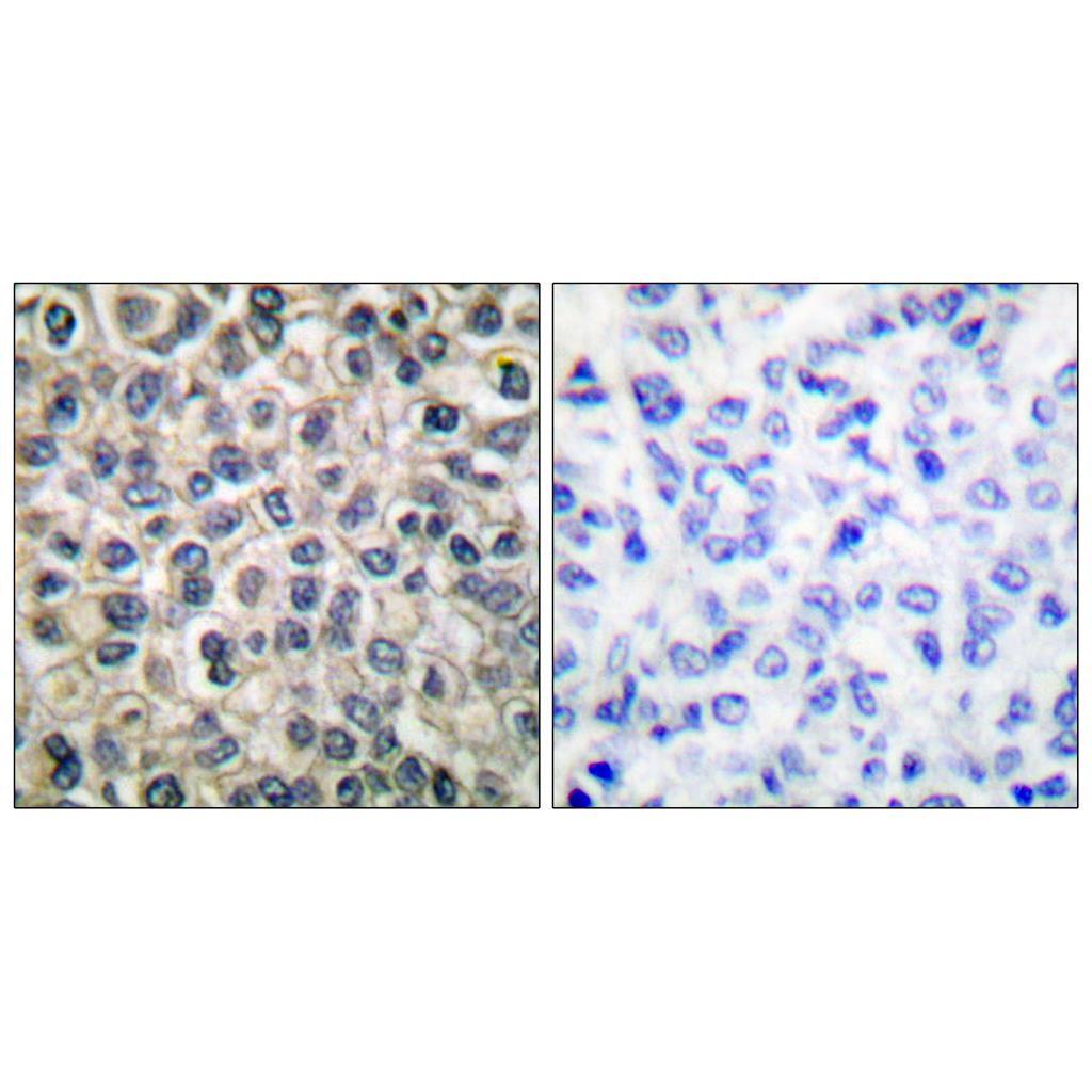 Catenin-γ Rabbit Polyclonal Antibody | 兔多抗 | EnkiLife恩玑生命