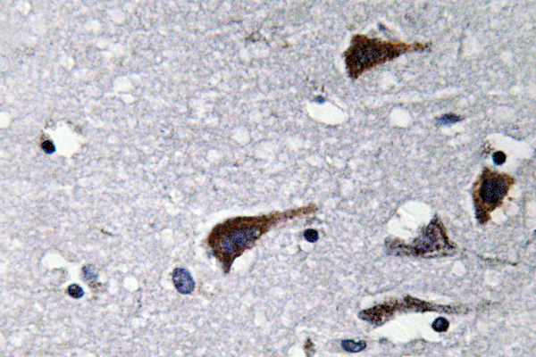 Cathepsin B Rabbit Polyclonal Antibody | 兔多抗 | EnkiLife恩玑生命