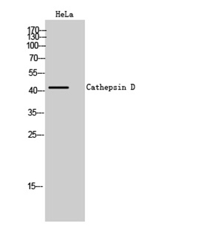 Cathepsin D Rabbit Polyclonal Antibody | 兔多抗 | EnkiLife恩玑生命