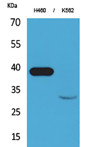 Cathepsin L Rabbit Polyclonal Antibody | 兔多抗 | EnkiLife恩玑生命