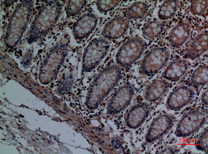 Cathepsin L Rabbit Polyclonal Antibody | 兔多抗 | EnkiLife恩玑生命