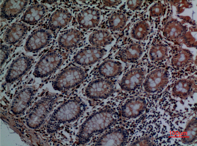 Cathepsin L Rabbit Polyclonal Antibody | 兔多抗 | EnkiLife恩玑生命