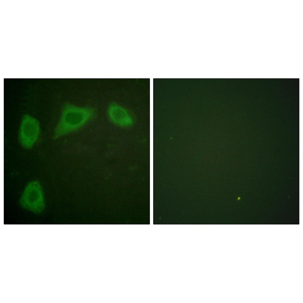 Caveolin-1 Rabbit Polyclonal Antibody | 兔多抗 | EnkiLife恩玑生命