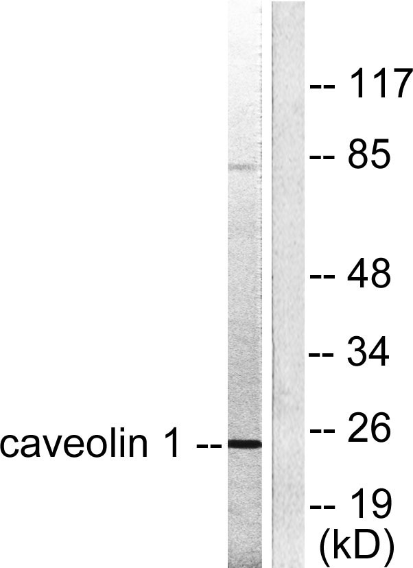 Caveolin-1 Rabbit Polyclonal Antibody | 兔多抗 | EnkiLife恩玑生命