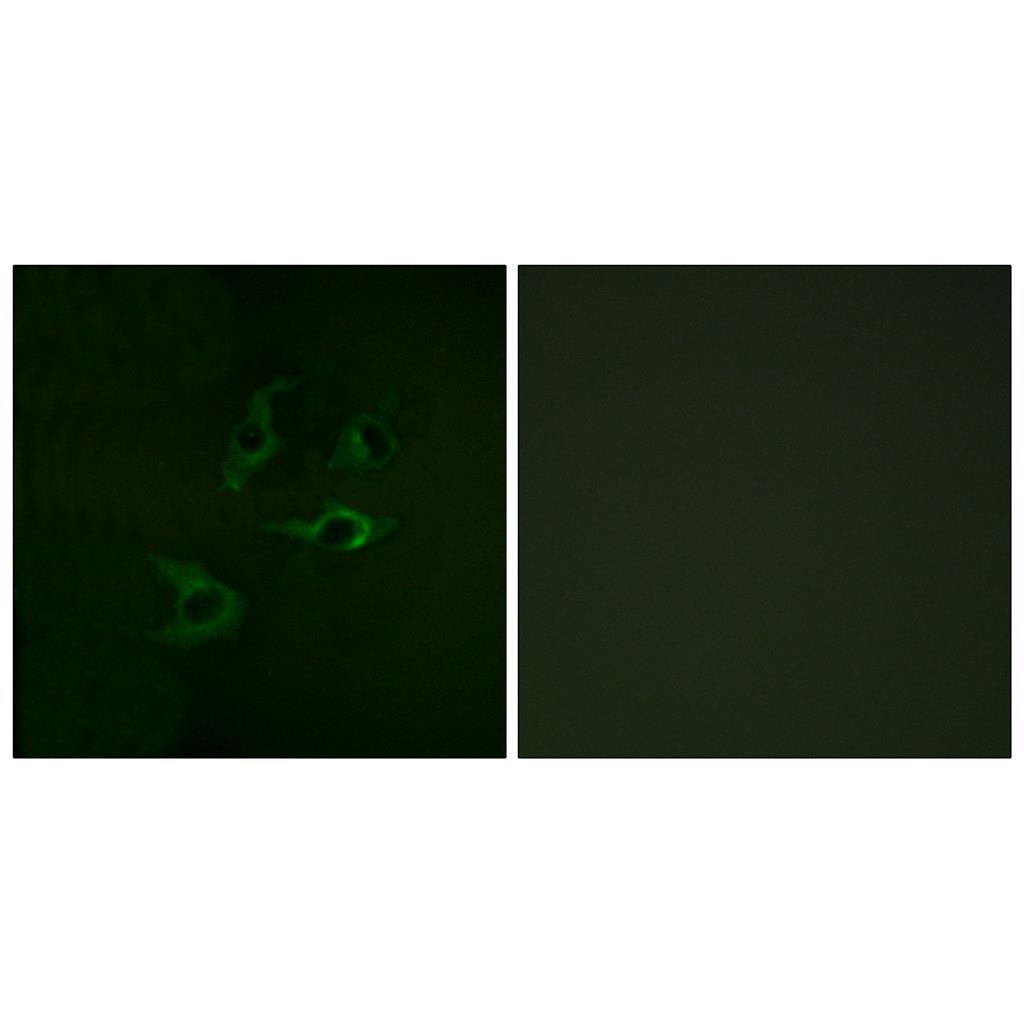 Cbl Rabbit Polyclonal Antibody | 兔多抗 | EnkiLife恩玑生命