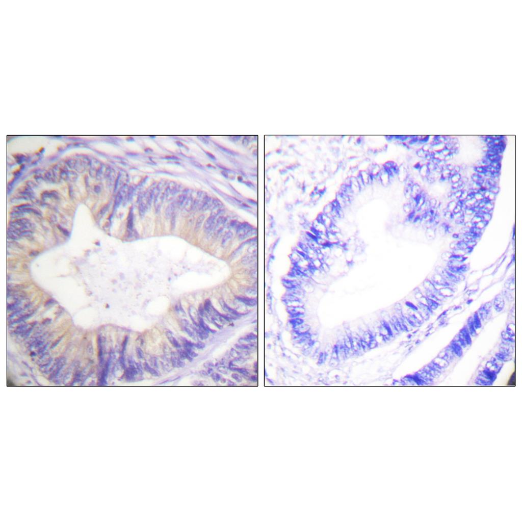 Cbl Rabbit Polyclonal Antibody | 兔多抗 | EnkiLife恩玑生命