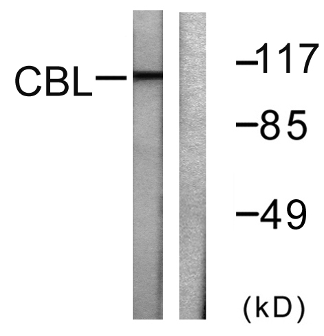Cbl Rabbit Polyclonal Antibody | 兔多抗 | EnkiLife恩玑生命