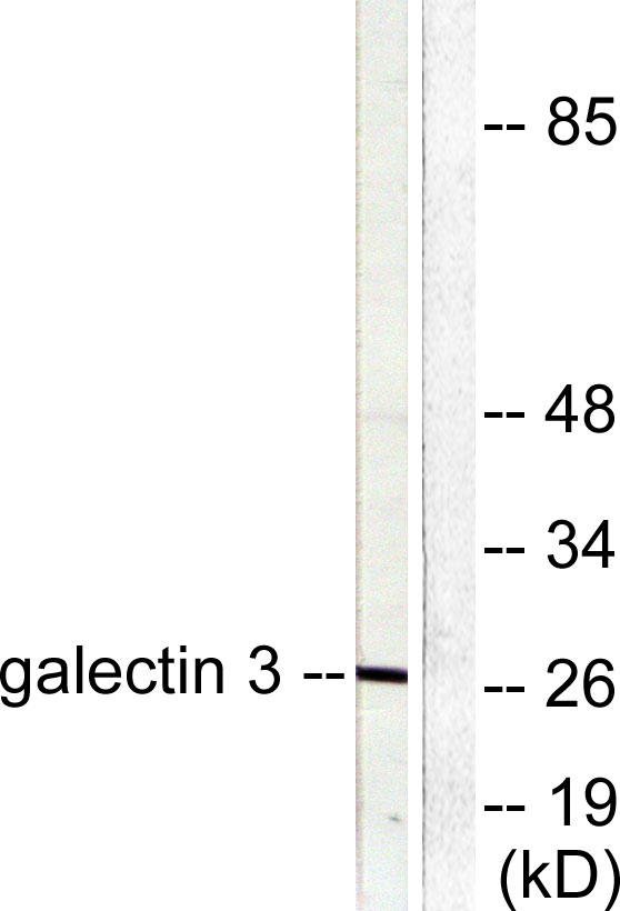 CBP 35 Rabbit Polyclonal Antibody | 兔多抗 | EnkiLife恩玑生命