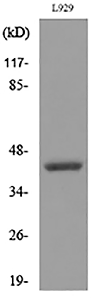 CD116 Rabbit Polyclonal Antibody | 兔多抗 | EnkiLife恩玑生命