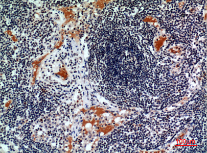 CD116 Rabbit Polyclonal Antibody | 兔多抗 | EnkiLife恩玑生命