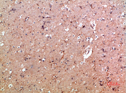 CD11b Rabbit Polyclonal Antibody | 兔多抗 | EnkiLife恩玑生命