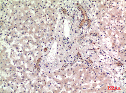 CD13 Rabbit Polyclonal Antibody | 兔多抗 | EnkiLife恩玑生命