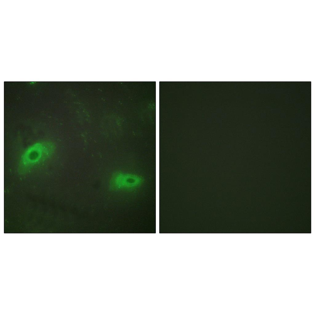 CD137L Rabbit Polyclonal Antibody | 兔多抗 | EnkiLife恩玑生命