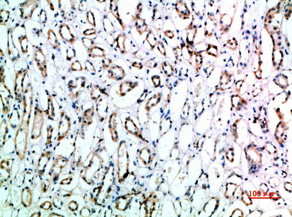 CD151 Rabbit Polyclonal Antibody | 兔多抗 | EnkiLife恩玑生命