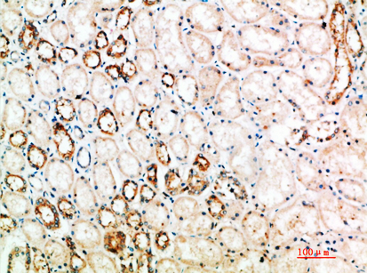 CD152 Rabbit Polyclonal Antibody | 兔多抗 | EnkiLife恩玑生命