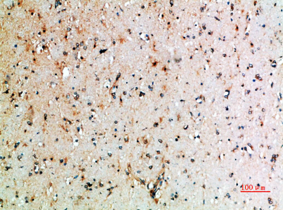 CD152 Rabbit Polyclonal Antibody | 兔多抗 | EnkiLife恩玑生命