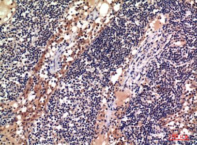 CD156c Rabbit Polyclonal Antibody | 兔多抗 | EnkiLife恩玑生命