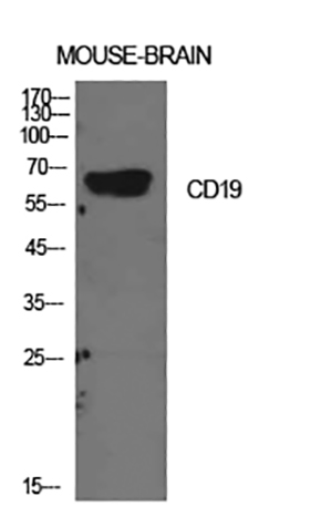 CD19 Rabbit Polyclonal Antibody | 兔多抗 | EnkiLife恩玑生命