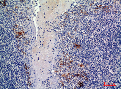 CD19 Rabbit Polyclonal Antibody | 兔多抗 | EnkiLife恩玑生命