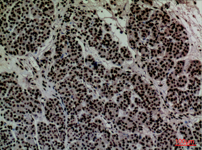 CD2 Rabbit Polyclonal Antibody | 兔多抗 | EnkiLife恩玑生命