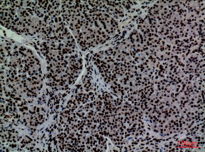 CD2 Rabbit Polyclonal Antibody | 兔多抗 | EnkiLife恩玑生命