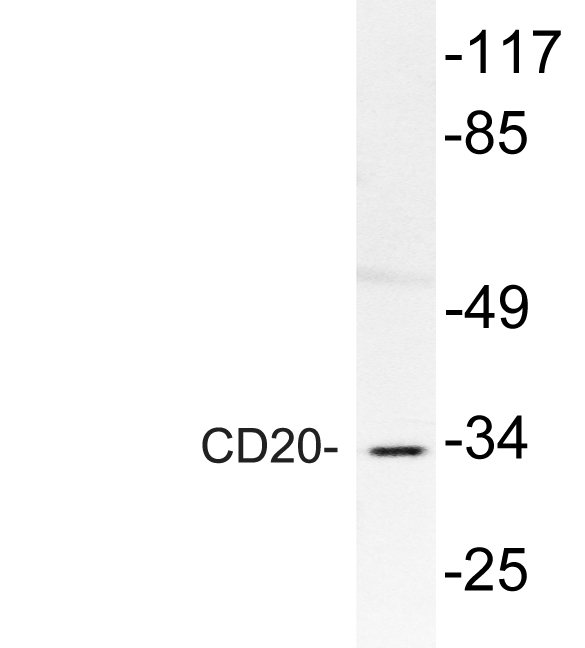 CD20 Rabbit Polyclonal Antibody | 兔多抗 | EnkiLife恩玑生命