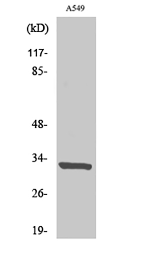 CD20 Rabbit Polyclonal Antibody | 兔多抗 | EnkiLife恩玑生命