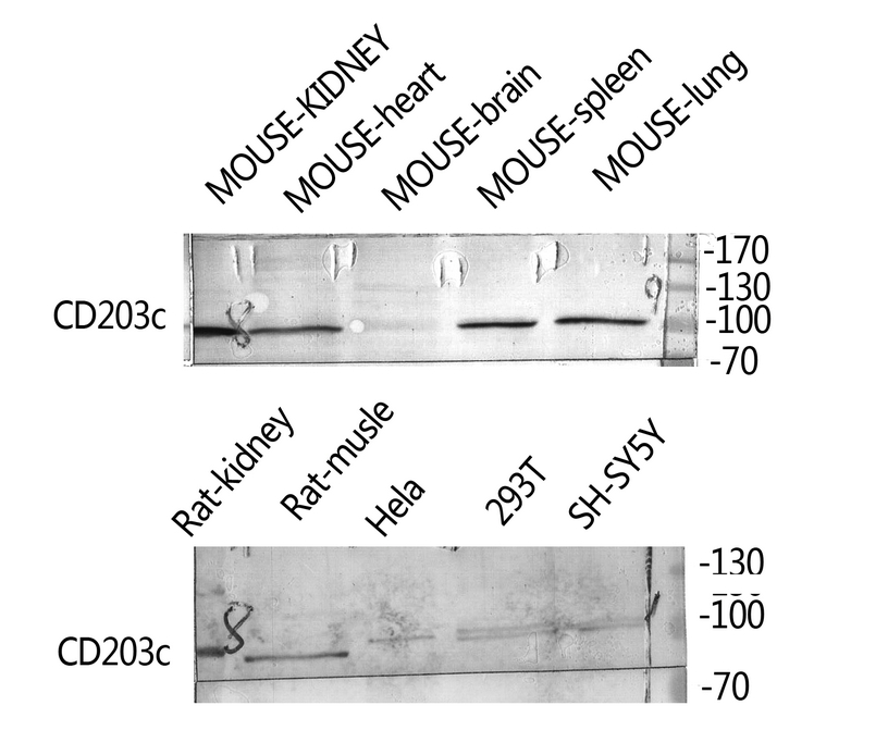 CD203c Rabbit Polyclonal Antibody | 兔多抗 | EnkiLife恩玑生命