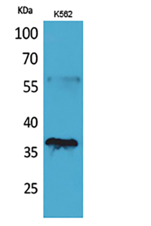 CD207 Rabbit Polyclonal Antibody | 兔多抗 | EnkiLife恩玑生命