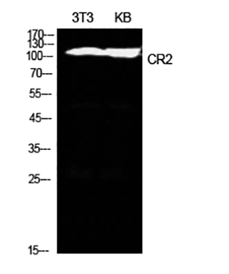 CD21 Rabbit Polyclonal Antibody | 兔多抗 | EnkiLife恩玑生命