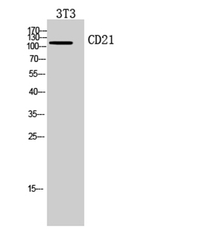 CD21 Rabbit Polyclonal Antibody | 兔多抗 | EnkiLife恩玑生命