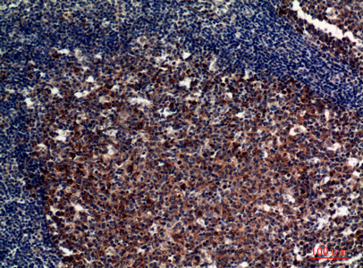 CD21 Rabbit Polyclonal Antibody | 兔多抗 | EnkiLife恩玑生命