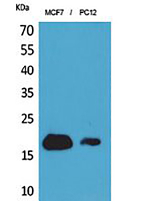 CD225 Rabbit Polyclonal Antibody | 兔多抗 | EnkiLife恩玑生命