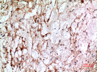 CD225 Rabbit Polyclonal Antibody | 兔多抗 | EnkiLife恩玑生命