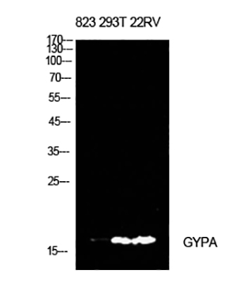 CD235a Rabbit Polyclonal Antibody | 兔多抗 | EnkiLife恩玑生命